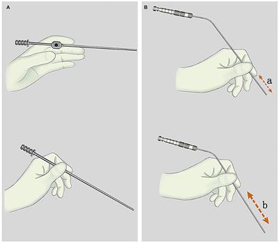 A new neurosurgical adjustable pressure suction apparatus with a mechanically controlled air inlet: the study of precise regulation and atraumatic suction